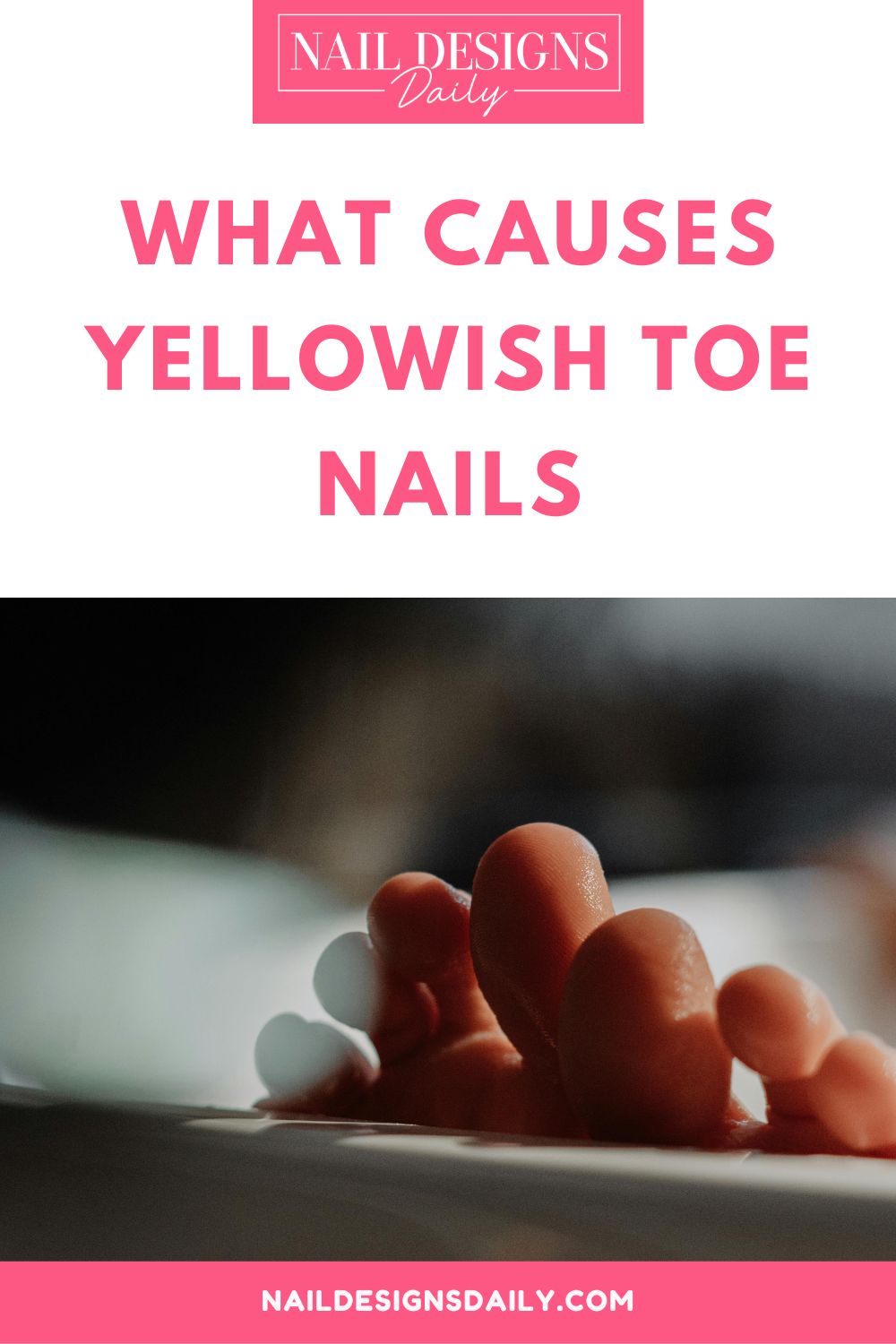 pinterest image for an article about What Causes Yellowish Toe Nails